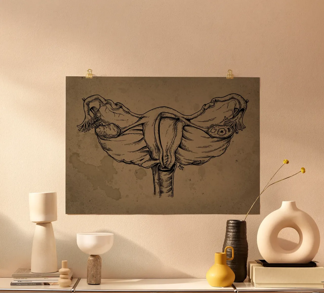 Uterus poster avec cadre en aluminium de Nora Back