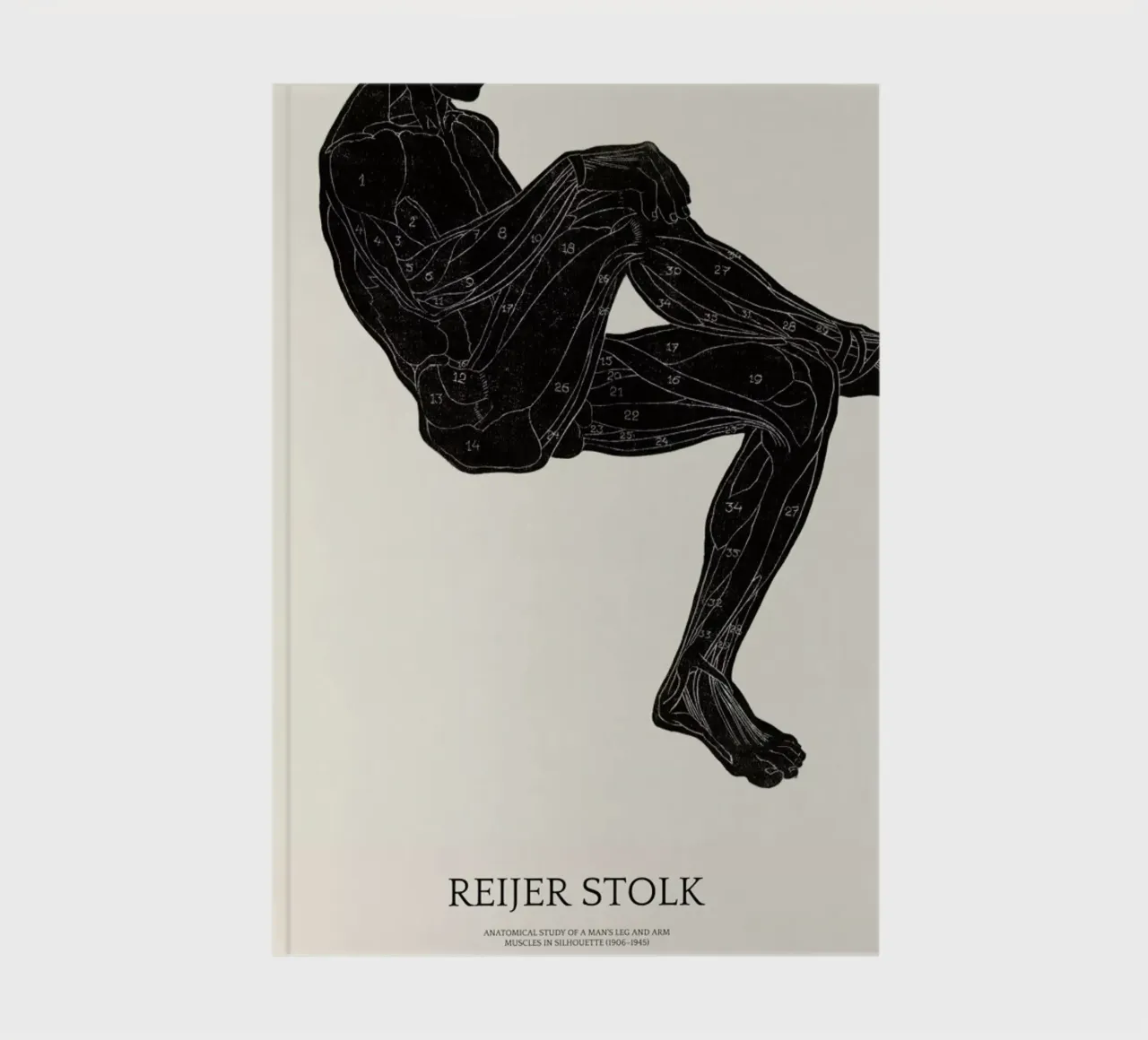Stolk - Anatomical Study of a Man's Leg and Arm Muscles notebook by Vintage by JUNIQE