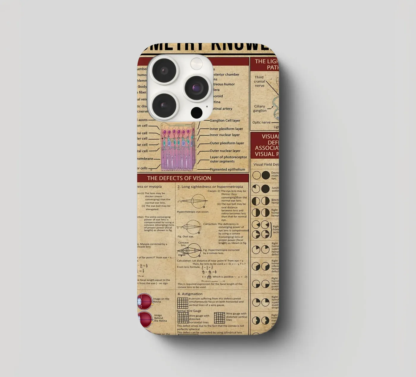 Optometry Knowledge Poster iphone case by Maritiknowled