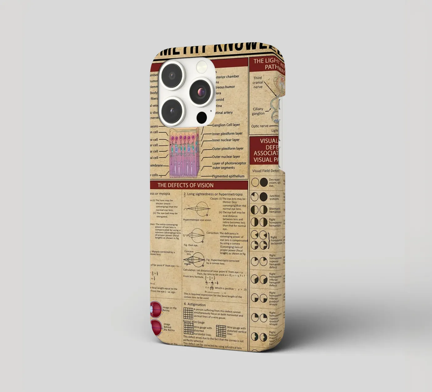 Optometry Knowledge Poster iphone case by Maritiknowled