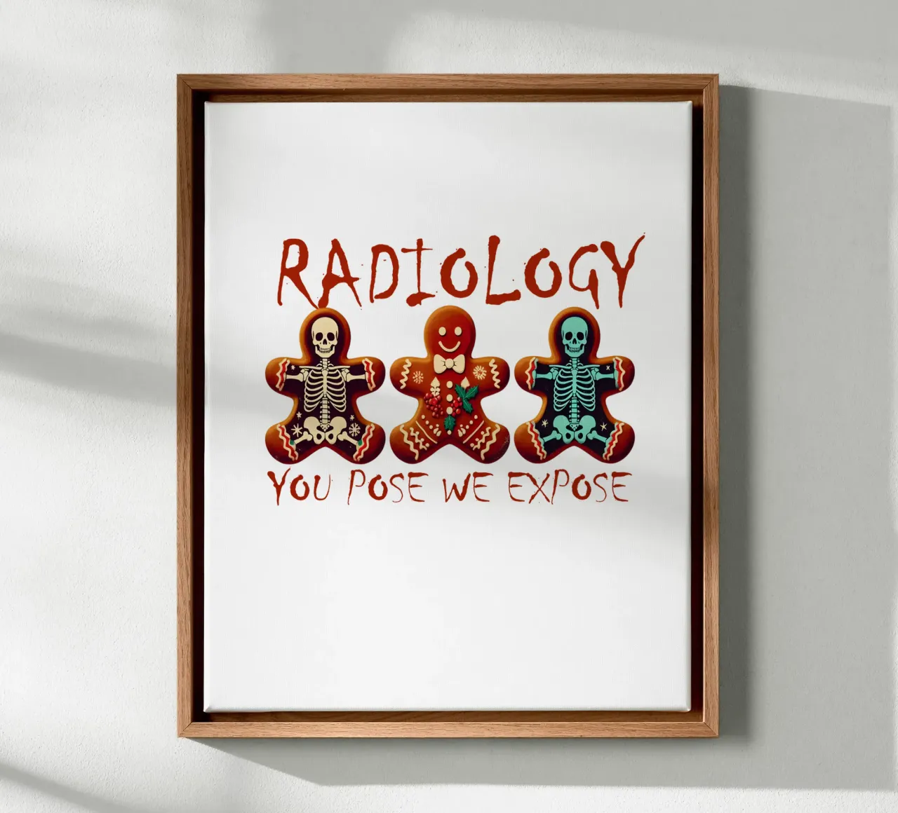 RADIOLOGY. YOU POSE WE EXPOSE canvas by edsonramosart